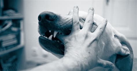 7 Pasos De Primeros Auxilios Para Tratar La Mordida De Un Perro