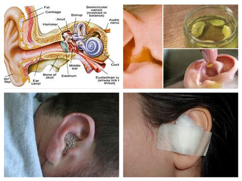 Say Goodbye To Ear Infection Cure Ear Infection In Just 1 Day 100
