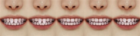 Most View Default Non Default Additional Maxis Teeth By Magic Bot