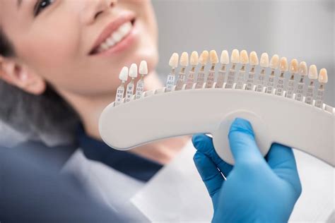 The Differences Between Dental Veneers And Composite Bonding James