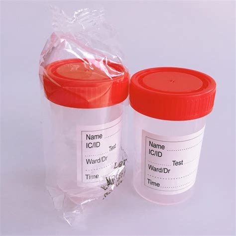 60ml 90ml Disposable Sterile Urine Specimen Drainage Cup With Label