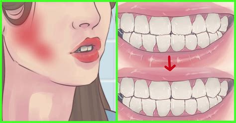 It does not always cause symptoms, but some people get most people who grind their teeth and clench their jaw are not aware they're doing it. How To Stop Grinding Your Teeth In Sleep
