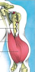 Biceps tendonitis is a well recognized source of anterior shoulder pain that may be associated with can show thickening and tenosynovitis of proximal biceps tendon. Biceps Tear or Injury | Mathew Mazoch, MD