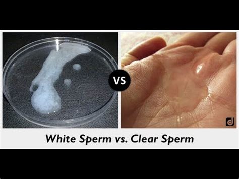 Difference Between White And Clear Sperm YouTube