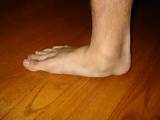 Pictures of Foot Flat