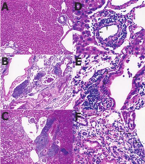 Histopathological Examinations Of A Representative Recipient With Gvhd