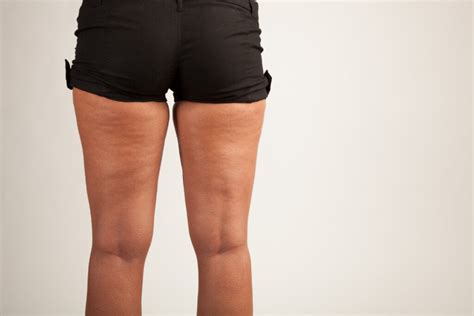 Hate Your Flabby Inner Thighs How To Firm Inner Thighs Scary Symptoms