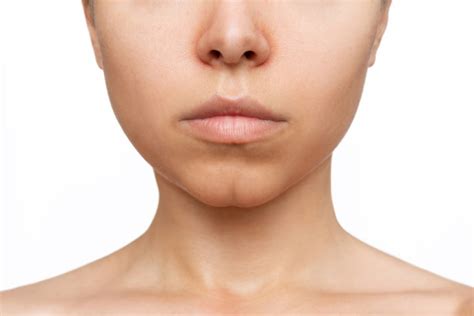 Understanding The Dimpled Chin Causes Treatment Options