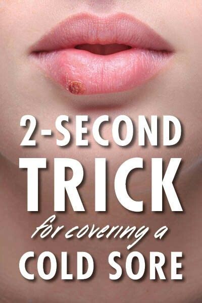 How To Cover A Cold Sore Scab On Lip Ryann Waller