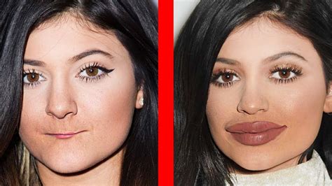 10 Celebrities Before And After Plastic Surgery