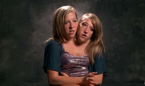 Clip from abby and brittany: Famous Conjoined Twins, Abby And Brittany Share Some News