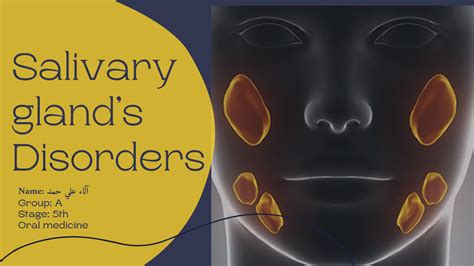 Solution Salivary Gland S Disorder Studypool