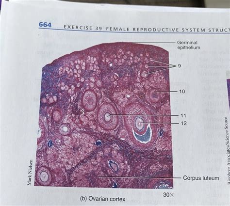 399 B Histology Of The Ovary Diagram Quizlet