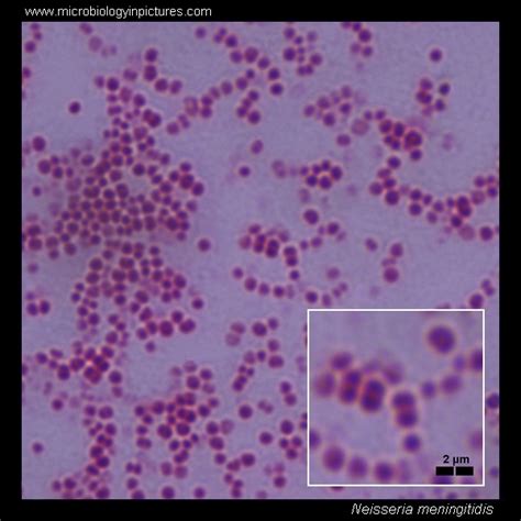 Neisseria Meningitidis Gram Stain And Cell Morphology Neisseria Meningitidis Micrograph