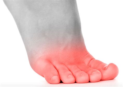 Foot Pain Diagnosis Chart Uk Reviews Of Chart