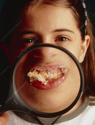 Close Up Of Girl S Mouth Stuffed With Cake Stock Image P Science Photo Library