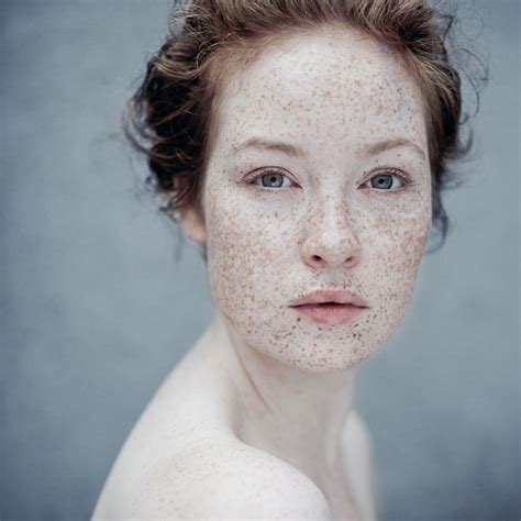 The Hypnotizing Beauty Of Freckles Pics
