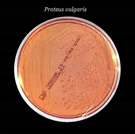Proteus Mirabilis Colony Morphology On Nutrient Agar Nutrienkarbo