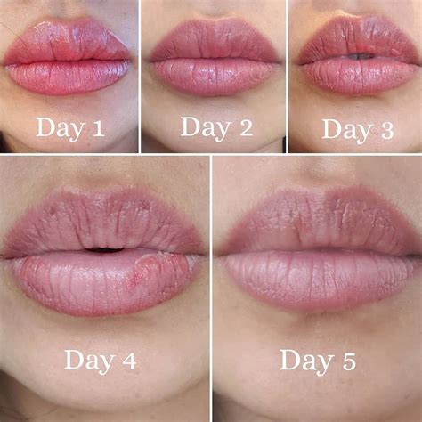 Permanent Makeup Lips Healing