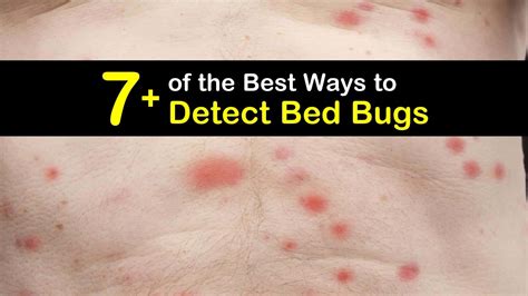 Of The Best Ways To Detect Bed Bugs