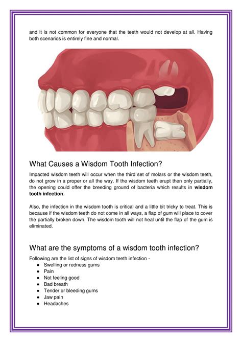 Ppt What To Do For An Infected Wisdom Tooth Powerpoint Presentation