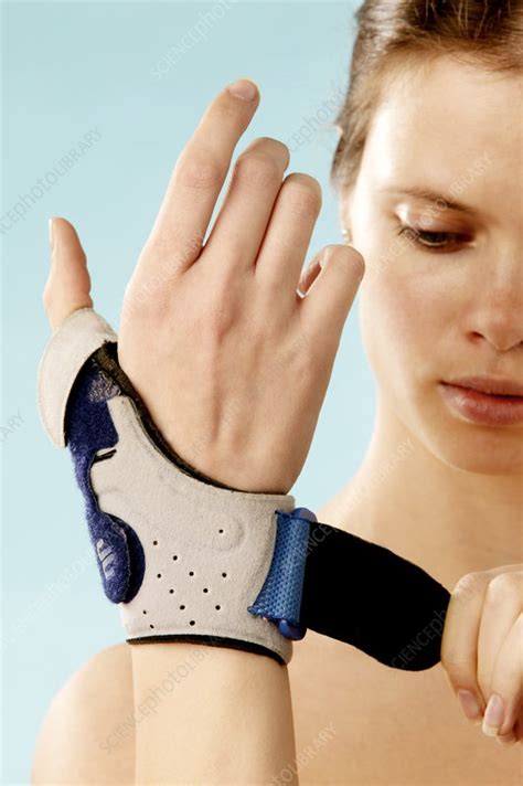 Sprained wrist - Stock Image - M330/1156 - Science Photo ...