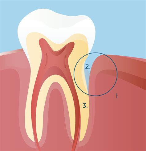 dental sensitivity its causes and treatment signal signal