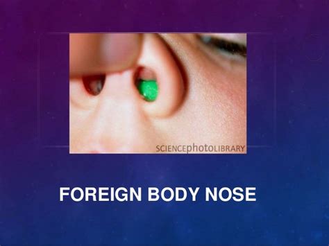 Foreign Body Nose