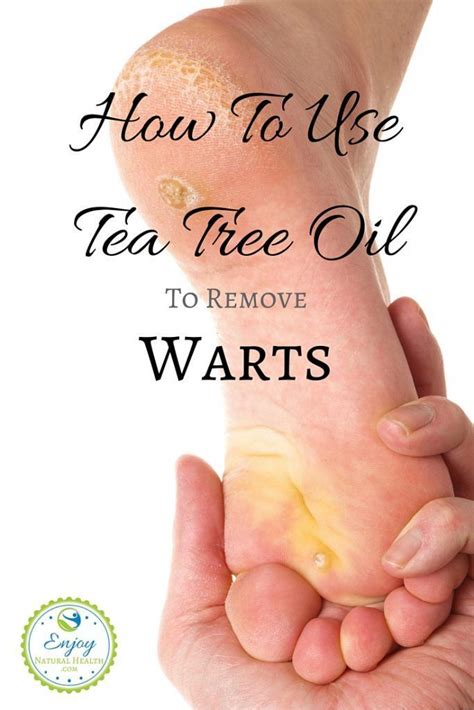 The wart removal stages for a plantar wart, (and the precautions) are the same as for any other wart, with one exception. Get Rid Of Stubborn Warts With Tea Tree Oil! | Tea tree ...