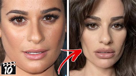 Top 10 Buccal Fat Removal Surgeries That Destroyed A Celebrities Face