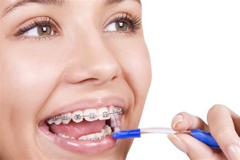 7 Tips For Keeping Your Braces Clean Orthodontist In Henderson Nv