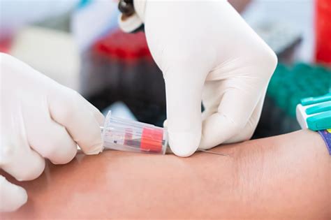 Nurse Collecting A Blood From Patient In Hospital Stock Photo