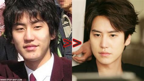 10 Shocking Korean Idol Plastic Surgery Transformations
