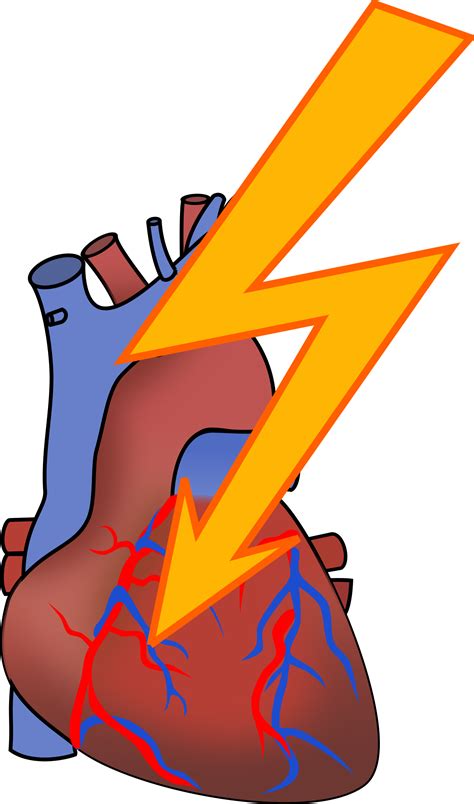 Heart Disease Clipart Free Download On Clipartmag