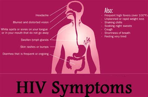 Common Symptoms Of Hivaids