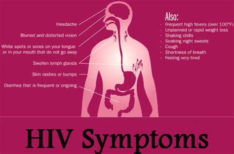 Early testing can help a person receive effective treatment and prevent transmission. COMMON SYMPTOMS OF HIV/AIDS
