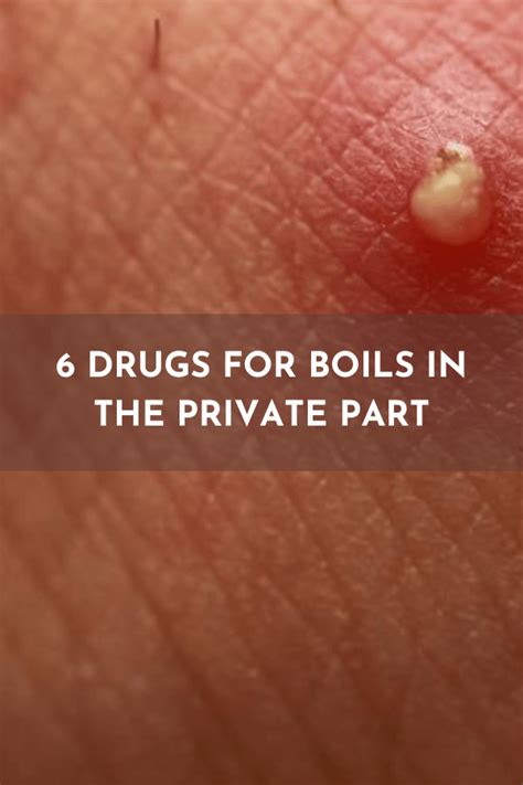 5 Drugs For Boils In The Private Part Choose The Right Treatment