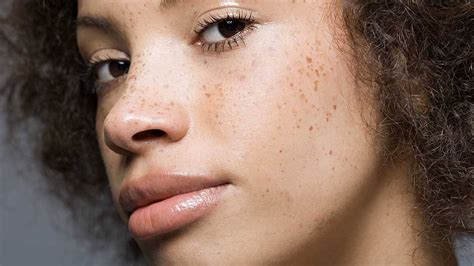 The skin absorbs uv rays and produces excess melanin that results in pigmentation in small patches. How to Get Fake Freckles with Makeup - L'Oréal Paris