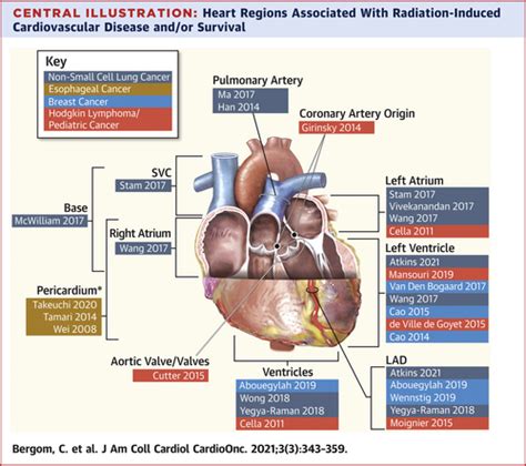 Past Present And Future Of Radiation Induced Cardiotoxicity