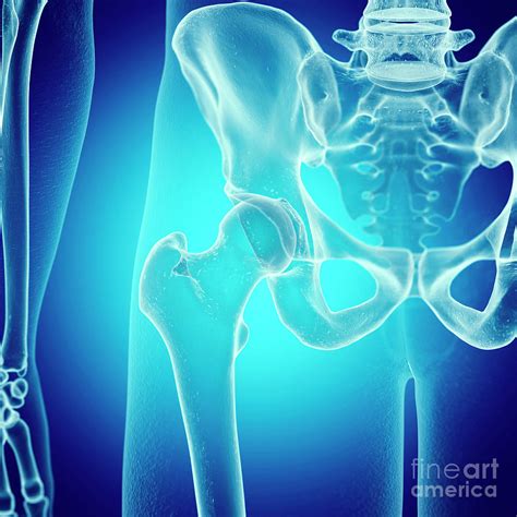 Illustration Of The Hip Bones Photograph By Sebastian Kaulitzkiscience Photo Library Pixels