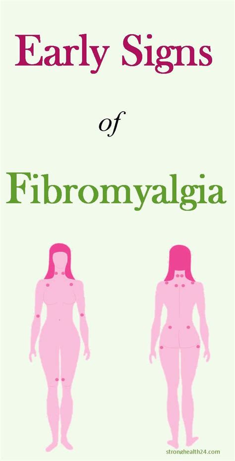 Early Signs Of Fibromyalgia Symptoms Signs Of Fibromyalgia Fibromyalgia Symptoms