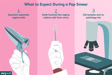 overview of the pap smear procedure