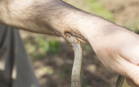 How To Treat A Poisonous Snake Bite Modern Survival
