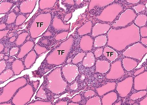 Thyroid Gland Veterinary Histology