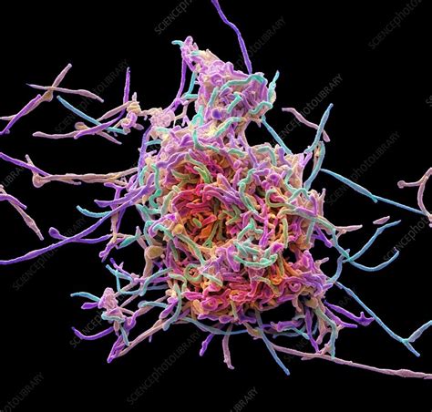 Mycoplasma Pneumoniae Sem Stock Image C0288603 Science Photo