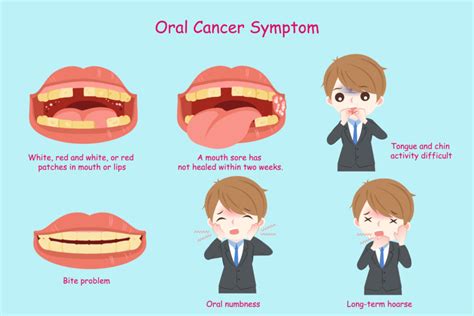 What You Need To Know About Oral Cancer Signs And Symptoms