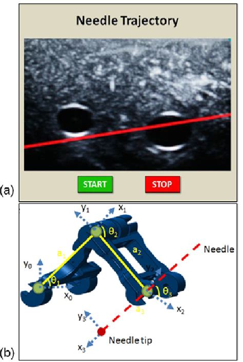 Figure 1 From Simple And Effective Ultrasound Needle Guidance System