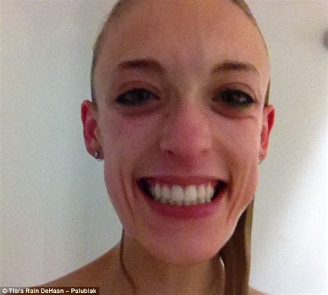 anorexic shares details about how the deadly eating disorder nearly killed her daily mail online
