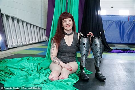 Double Amputee Reveals Moment She Found Out Her Feet Were Coming Off