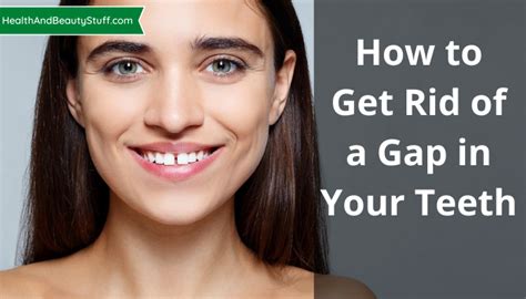 The basic principle is that you slip one teeth gap band * around your tooth gap and sleep the night away. How To Get Rid Of A Gap In Your Teeth